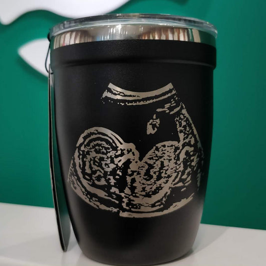 Personalized ultrasound engraved drinkware, showcasing black and white mugs and tumblers with custom engravings of ultrasound images and heartfelt messages as a tribute to expectant parents.